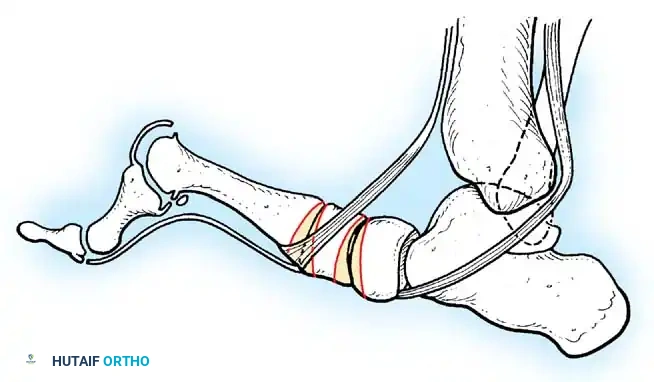 Hutaifortho's Orthopaedic Diagram