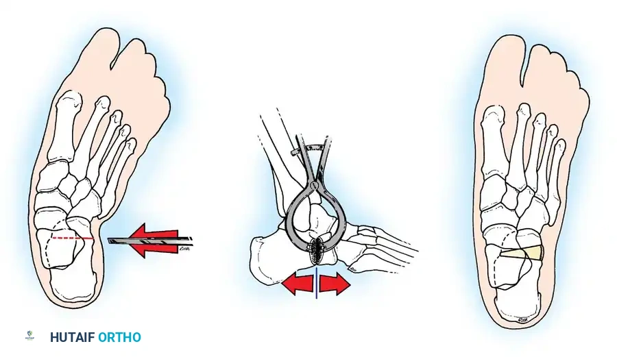 Hutaifortho's Orthopaedic Diagram