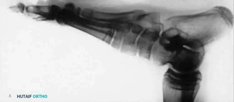 Hutaifortho's Orthopaedic Diagram