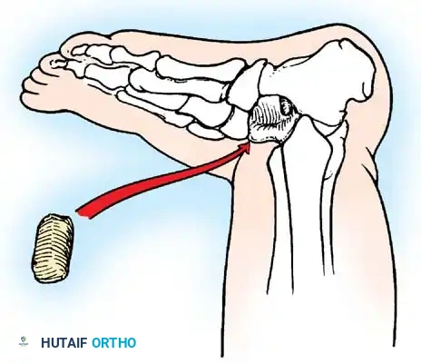 Hutaifortho's Orthopaedic Diagram