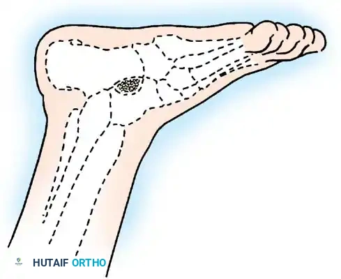 Hutaifortho's Orthopaedic Diagram