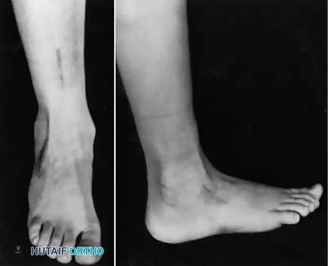 Hutaifortho's Orthopaedic Diagram