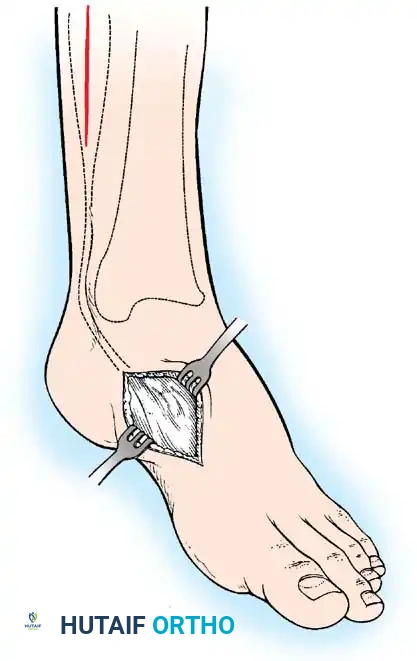 Hutaifortho's Orthopaedic Diagram