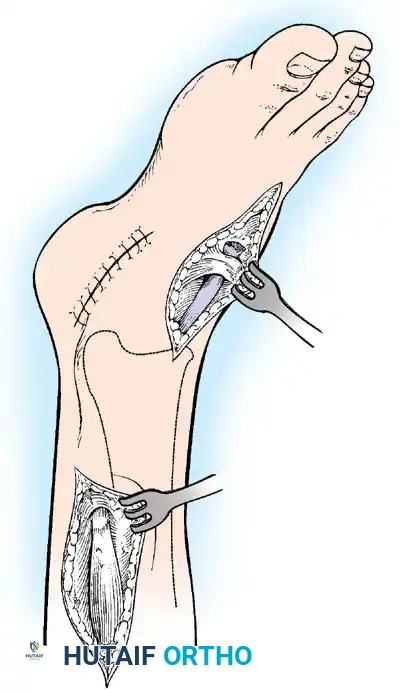 Hutaifortho's Orthopaedic Diagram