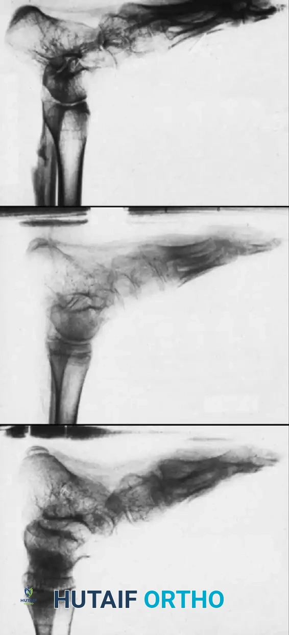 Hutaifortho's Orthopaedic Diagram
