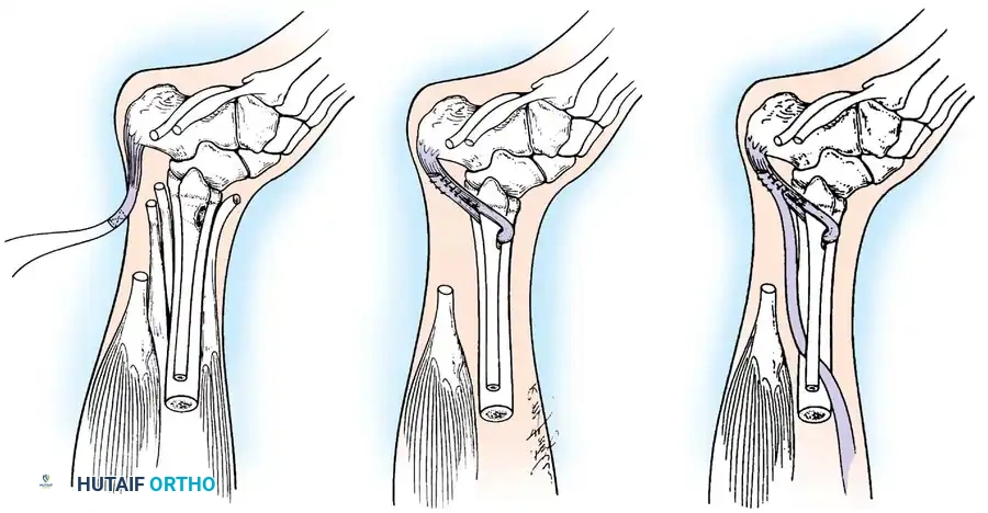 Hutaifortho's Orthopaedic Diagram