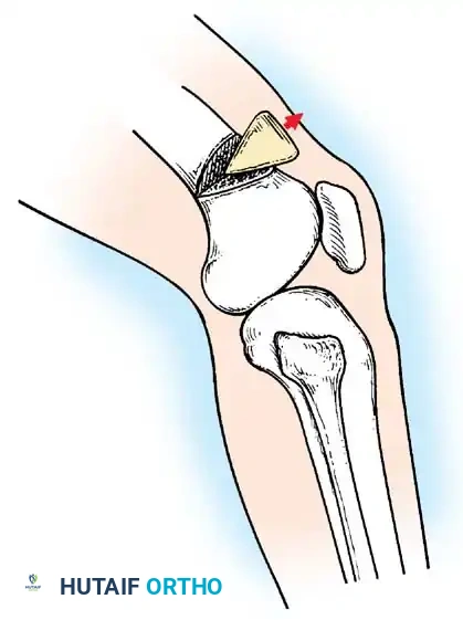 Hutaifortho's Orthopaedic Diagram