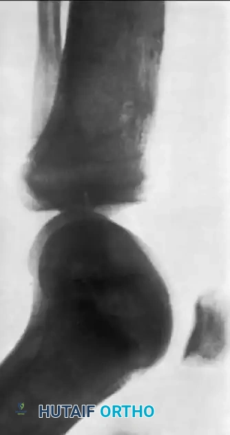 Hutaifortho's Orthopaedic Diagram