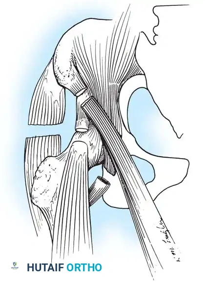 Hutaifortho's Orthopaedic Diagram
