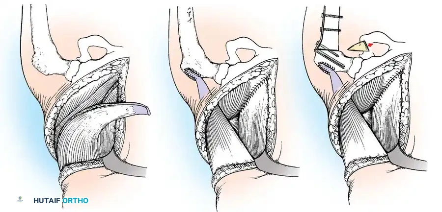 Hutaifortho's Orthopaedic Diagram