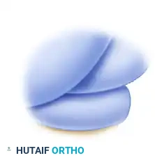 PORTAL PLACEMENT Surgical Diagram