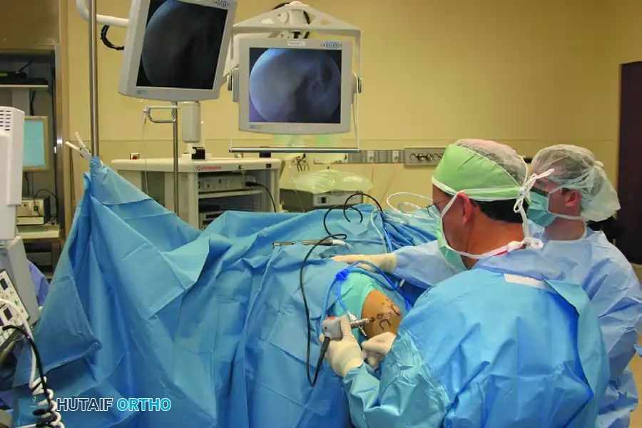 PORTAL PLACEMENT Surgical Diagram