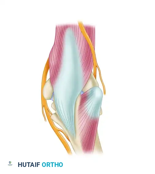 PORTAL PLACEMENT Surgical Diagram