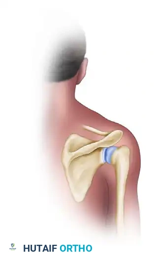 Saber cut skin incision