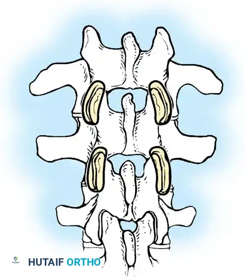 Hutaifortho's Orthopaedic Diagram