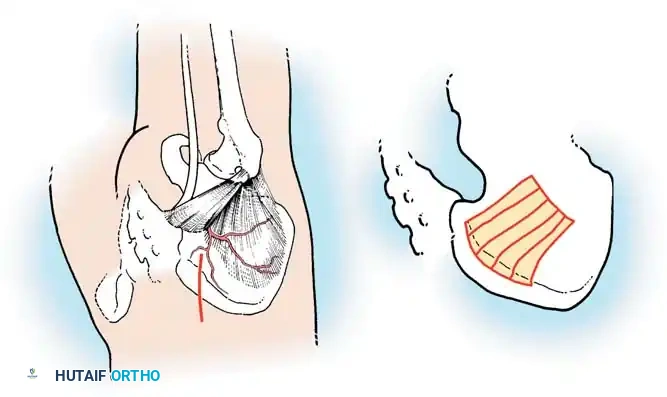 Hutaifortho's Orthopaedic Diagram