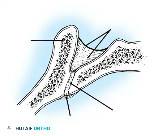 Hutaifortho's Orthopaedic Diagram