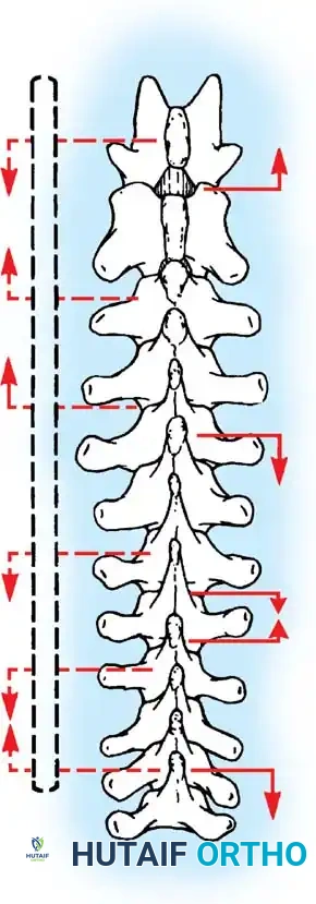 Hutaifortho's Orthopaedic Diagram