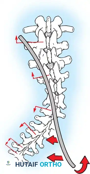 Hutaifortho's Orthopaedic Diagram
