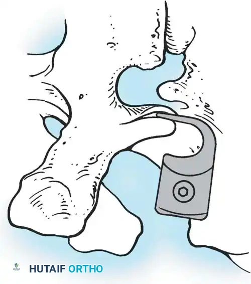 Hutaifortho's Orthopaedic Diagram
