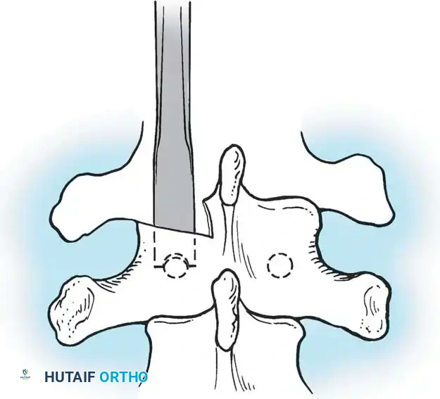 Hutaifortho's Orthopaedic Diagram