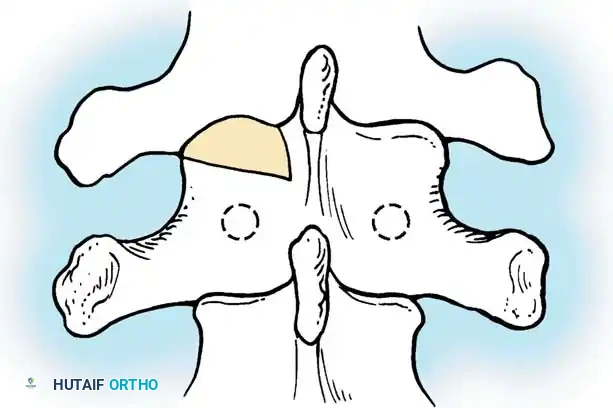 Hutaifortho's Orthopaedic Diagram
