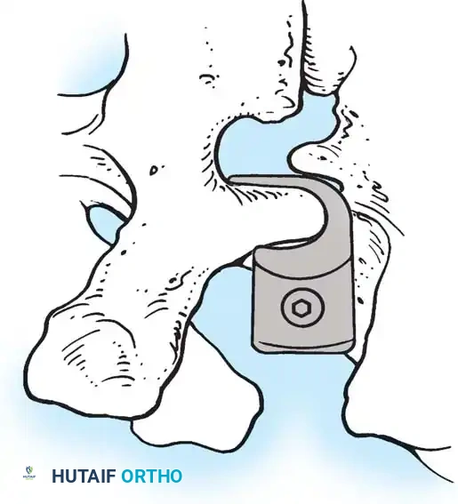 Hutaifortho's Orthopaedic Diagram