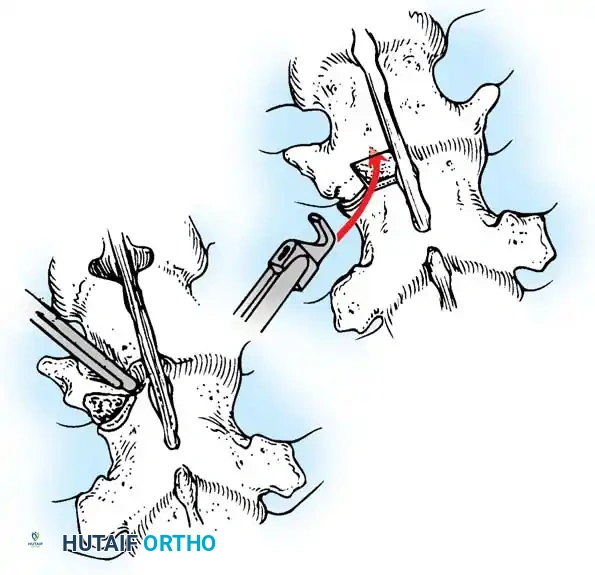 Hutaifortho's Orthopaedic Diagram