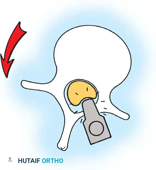 Hutaifortho's Orthopaedic Diagram
