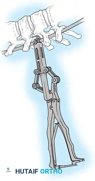 Hutaifortho's Orthopaedic Diagram