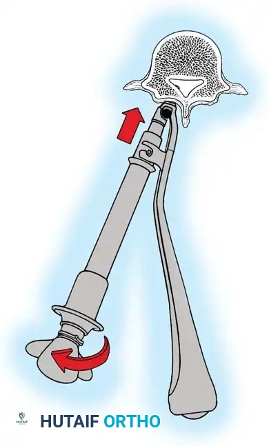 Hutaifortho's Orthopaedic Diagram