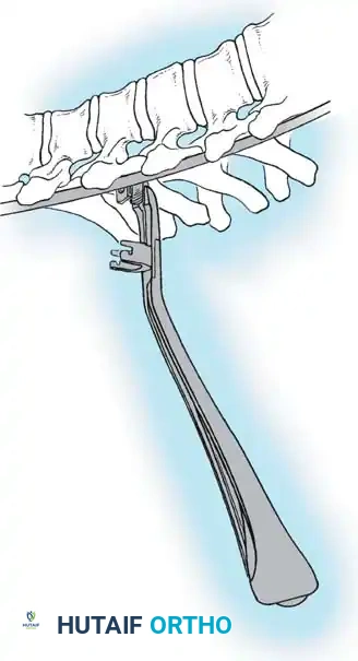 Hutaifortho's Orthopaedic Diagram