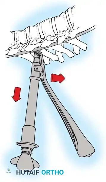 Hutaifortho's Orthopaedic Diagram