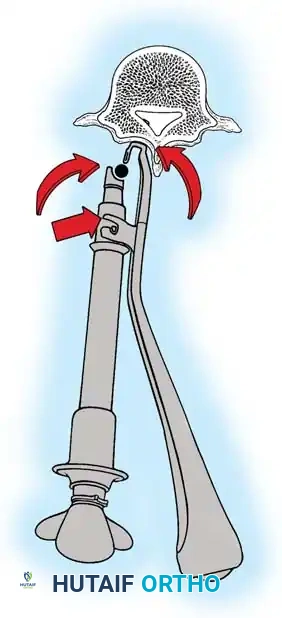 Hutaifortho's Orthopaedic Diagram