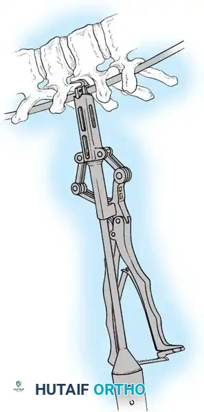 Hutaifortho's Orthopaedic Diagram