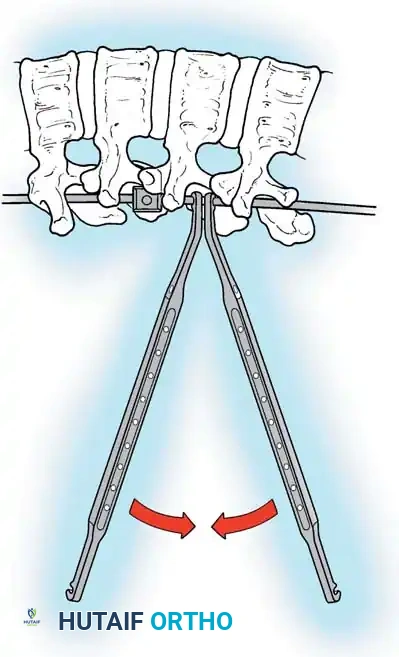 Hutaifortho's Orthopaedic Diagram