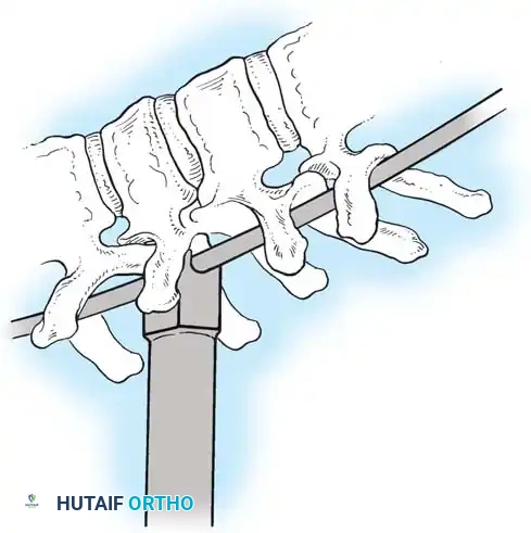 Hutaifortho's Orthopaedic Diagram
