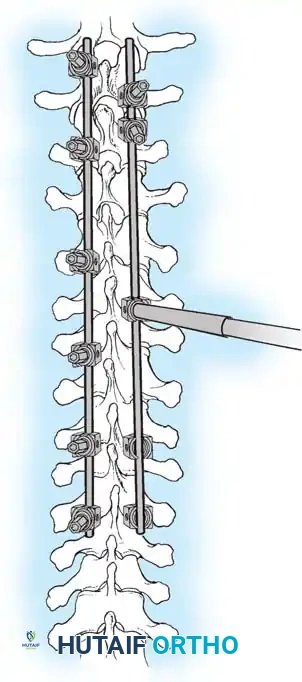 Hutaifortho's Orthopaedic Diagram