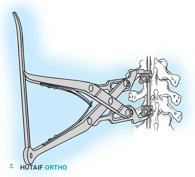 Hutaifortho's Orthopaedic Diagram