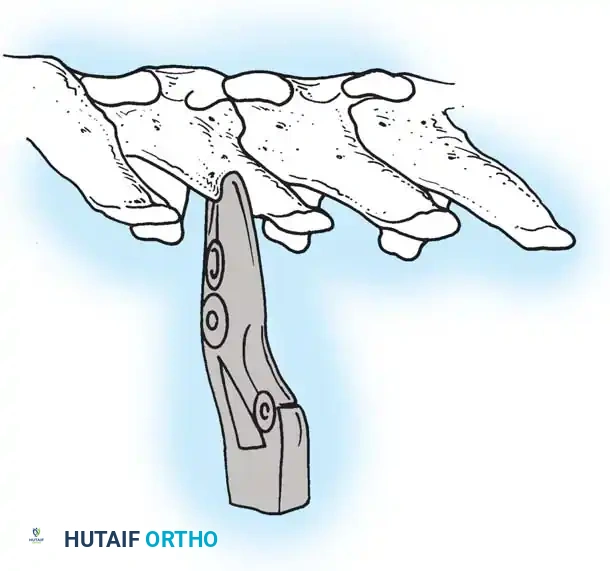 Hutaifortho's Orthopaedic Diagram