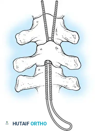 Hutaifortho's Orthopaedic Diagram