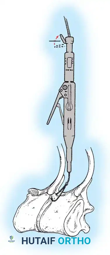 Hutaifortho's Orthopaedic Diagram