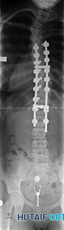 Hutaifortho's Orthopaedic Diagram