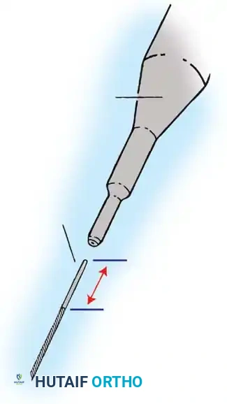 Hutaifortho's Orthopaedic Diagram