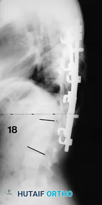 Hutaifortho's Orthopaedic Diagram