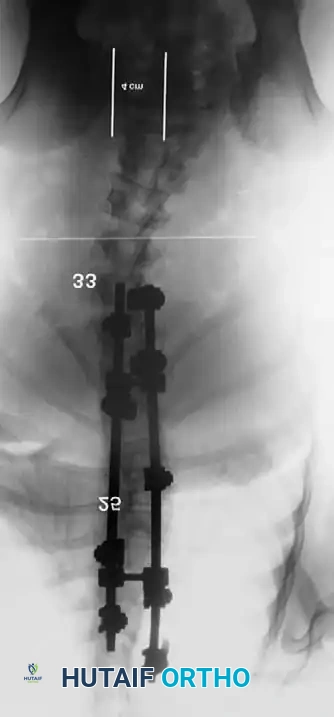 Hutaifortho's Orthopaedic Diagram