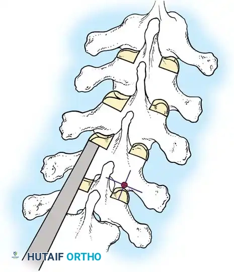 Hutaifortho's Orthopaedic Diagram
