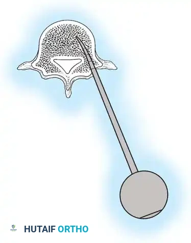Hutaifortho's Orthopaedic Diagram
