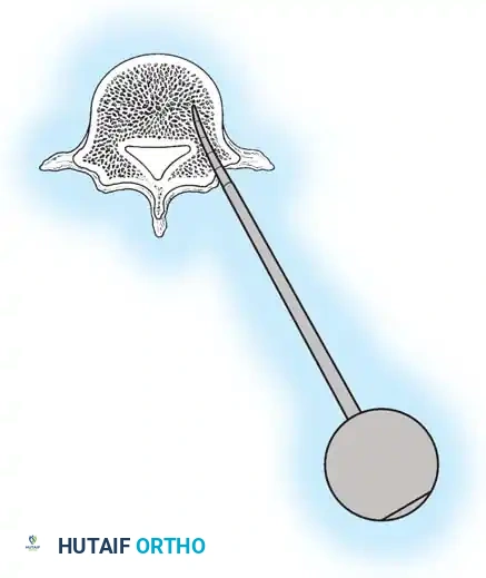Hutaifortho's Orthopaedic Diagram