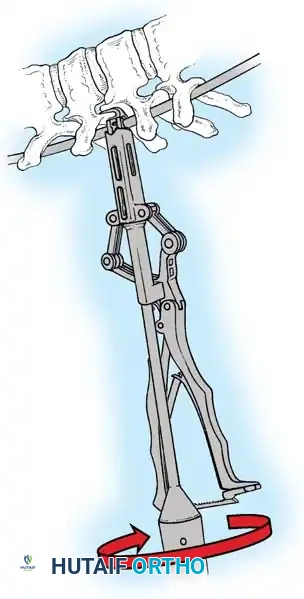 Hutaifortho's Orthopaedic Diagram